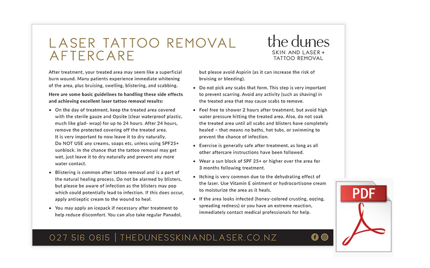 Tattoo Removal